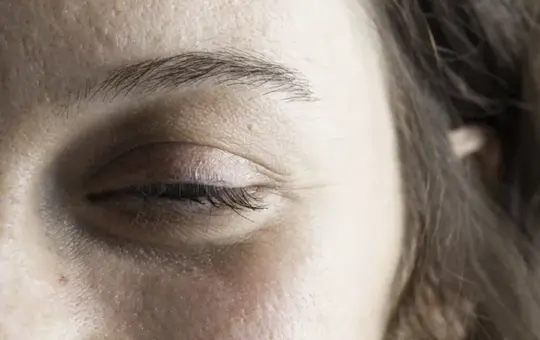 Ptosis Surgery